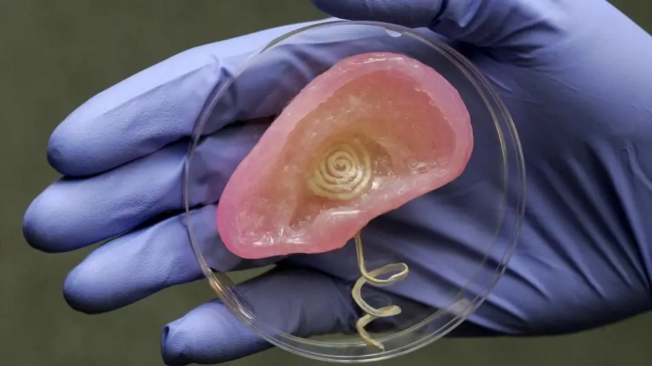 Impression 3D : des chercheurs inventent une super oreille