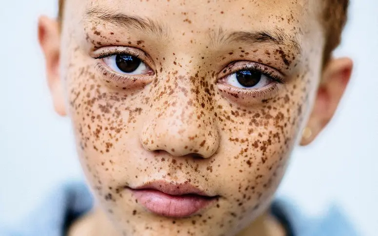 La beauté et la diversité des roux célébrées dans une série photo