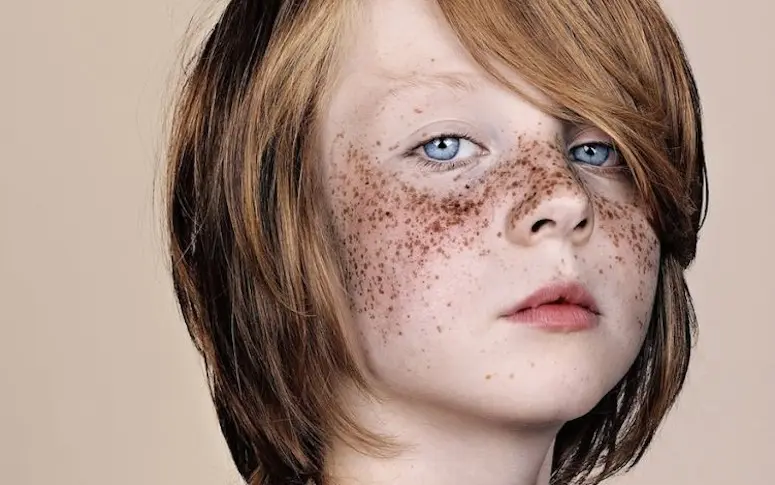 La beauté des tâches de rousseur célébrée dans une série photo