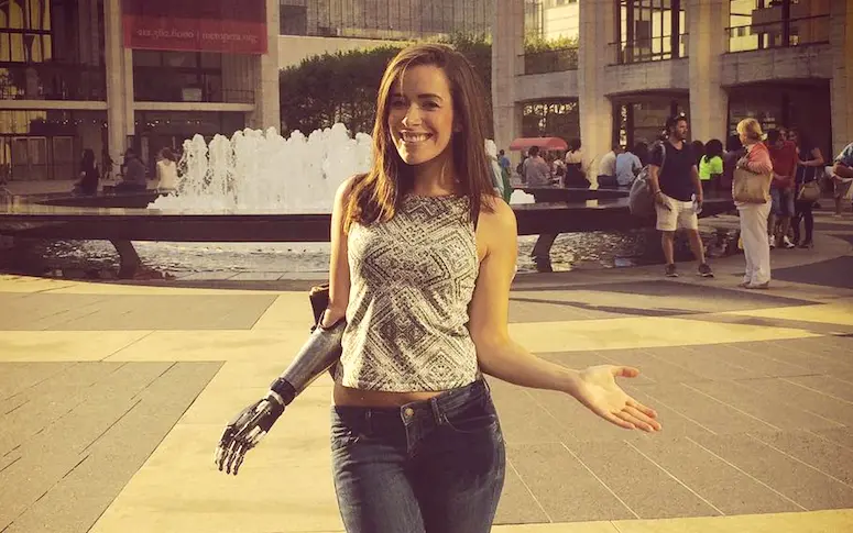 Un mannequin avec un bras bionique défilera à la Fashion Week de New York