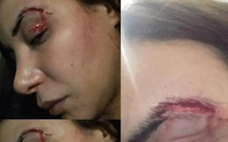 Loubna Abidar, héroïne de Much Loved, affirme avoir été agressée au Maroc