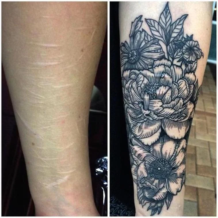 En Australie, une tatoueuse dissimule gratuitement les traces d’automutilation