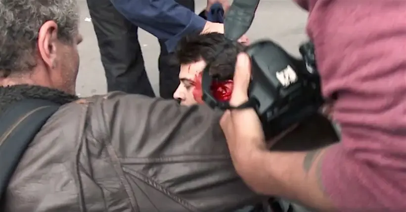 Vidéo : un journaliste gravement blessé par une grenade de désencerclement lancée par un policier