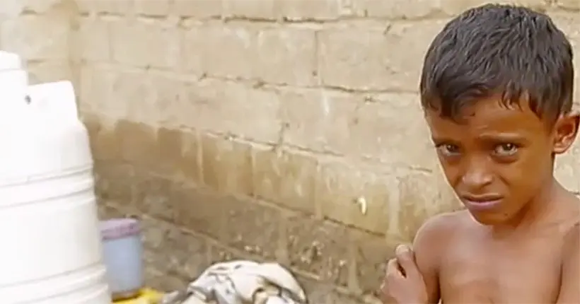 Les enfants en première ligne de la famine qui menace le Yémen