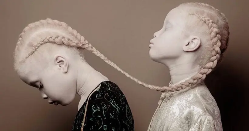 Au Brésil, ces jumelles albinos donnent un nouveau visage à l’industrie de la mode