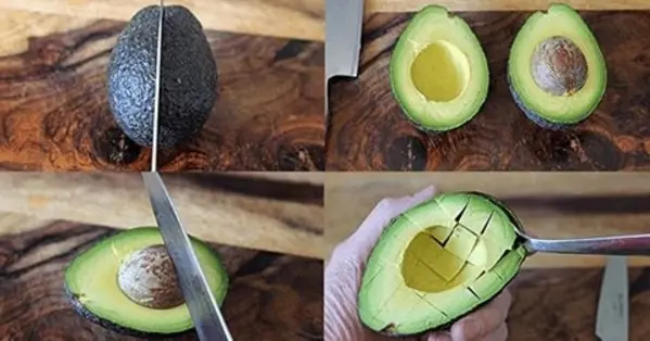 “Avocado hand” : quand la passion pour l’avocat devient dangereuse