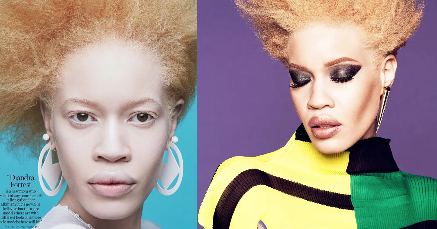 Diandra Forrest est la première égérie albinos d’une campagne de beauté