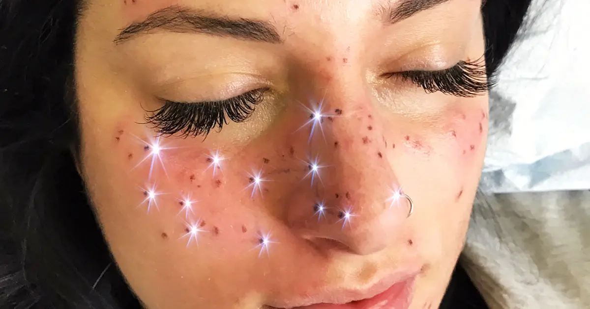 WTF : tatouez-vous une constellation du zodiaque sur le visage avec des taches de rousseur