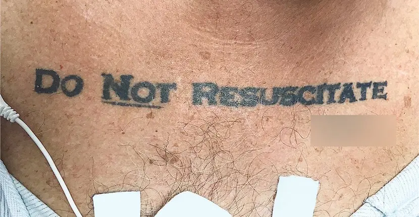 Un médecin doit-il réanimer un homme portant un tatouage demandant le contraire ?