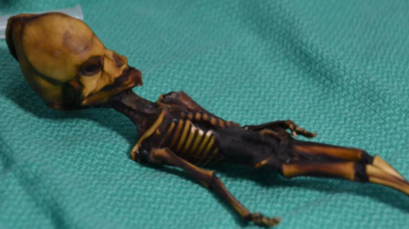Ce que l’on pensait être le corps d’un alien est en fait celui d’une fillette mort-née au XVIe siècle