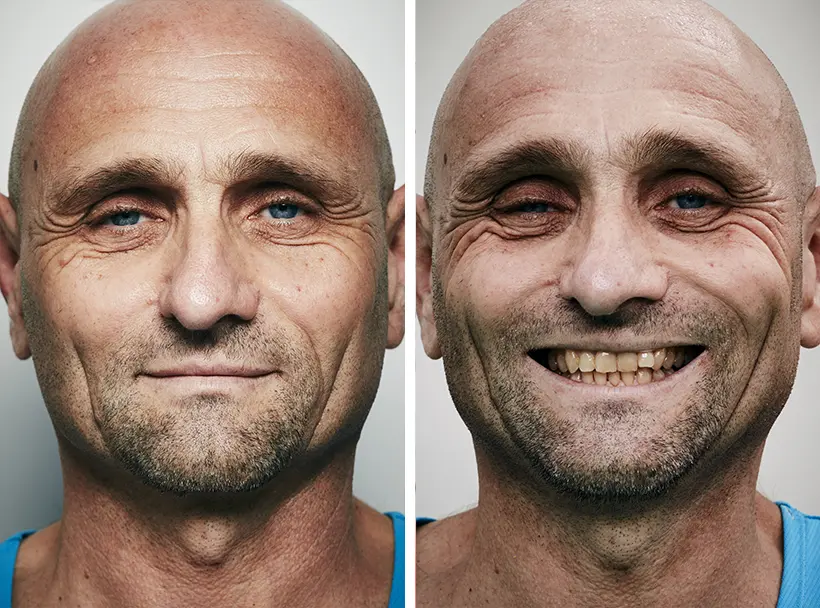 En images : le visage des coureurs avant et après le marathon de Paris