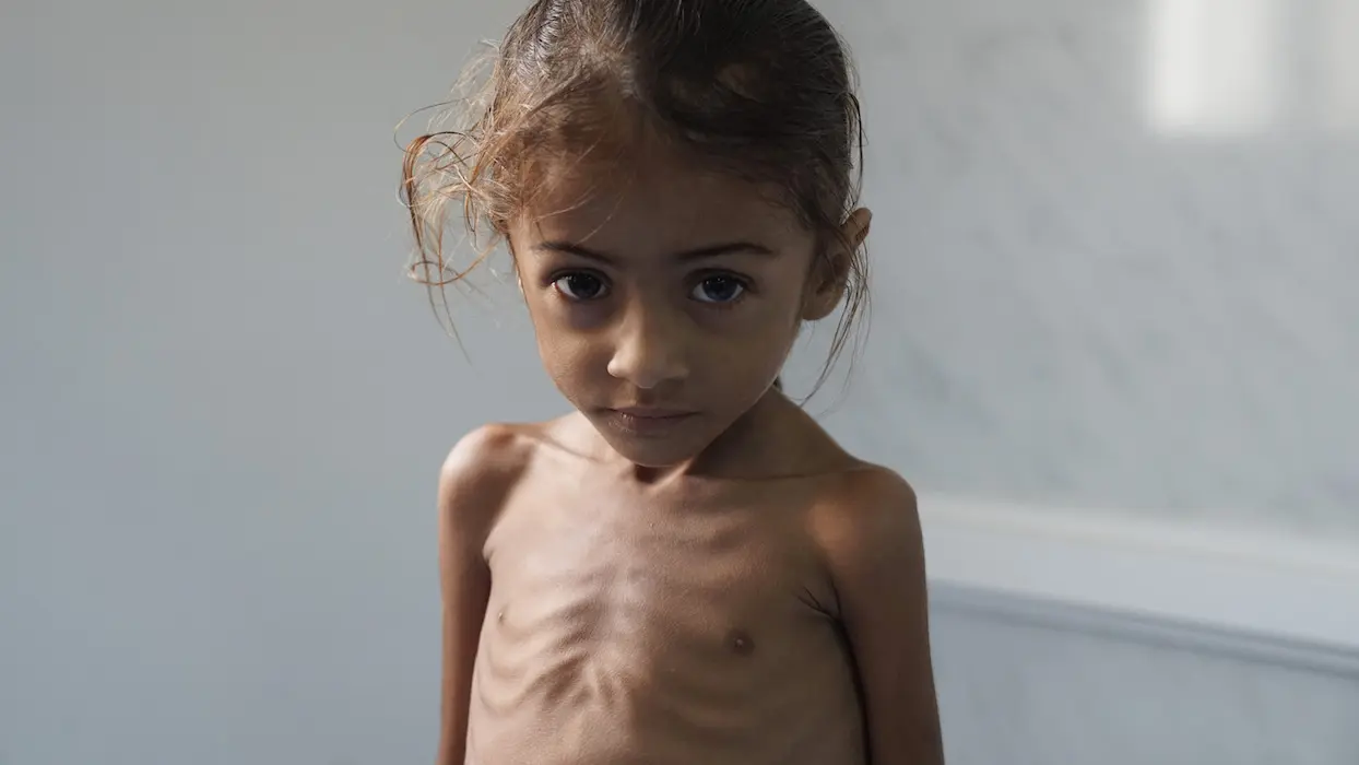 “La pire situation humanitaire au monde” : au Yémen, la famine pourrait toucher 14 millions de personnes