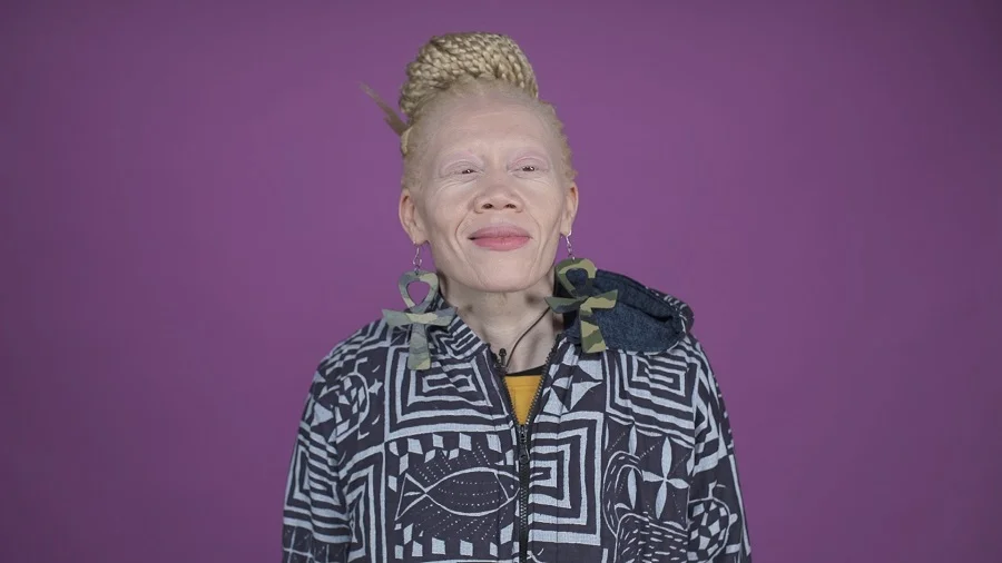 Vidéo : en Afrique, les albinos sont victimes d’une véritable chasse à l’homme