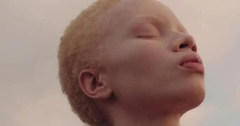 Une mannequin albinos pour la première fois en couverture de Vogue