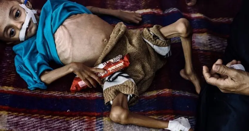 Prix Pulitzer 2019 : des photos sur la guerre au Yémen et les migrants récompensées