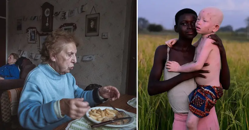 Nikon Photo Contest 2019 : de l’albinisme au Ghana à l’Alzheimer, les lauréats révélés