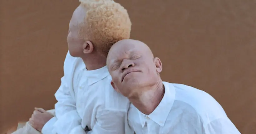 La beauté des hommes albinos en Tanzanie sublimée par Denisse Ariana Pérez