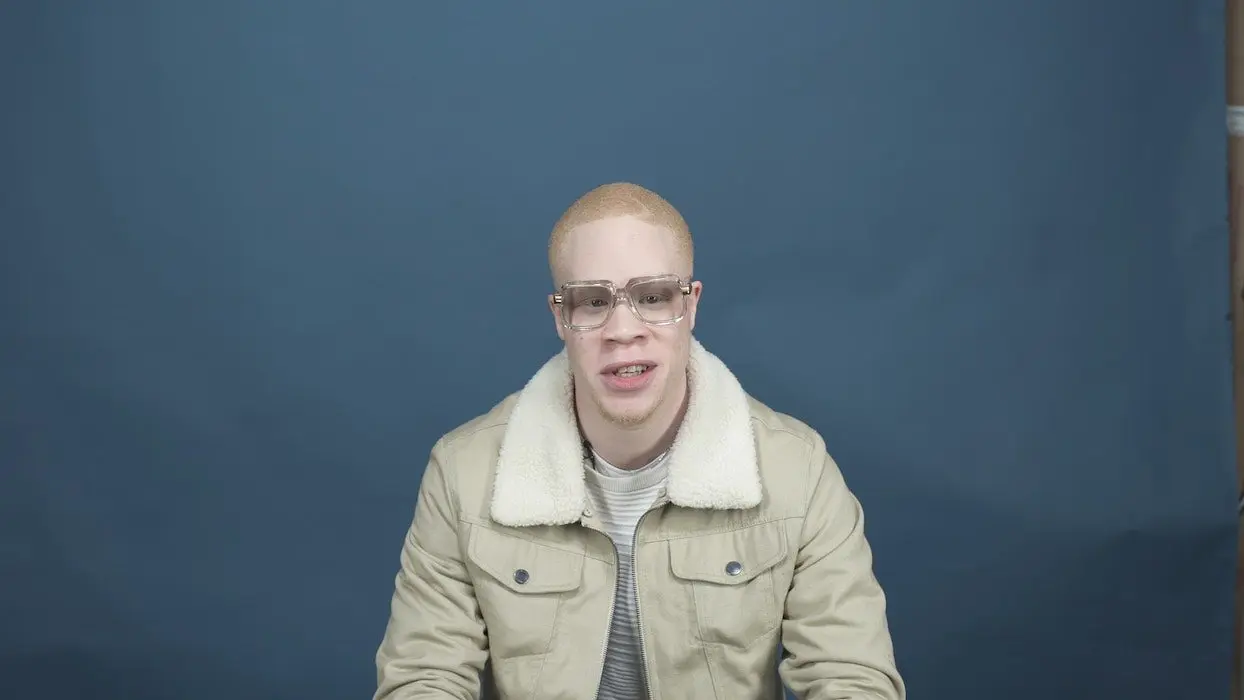Vidéo : albinos, j’ai fait de ma différence une force