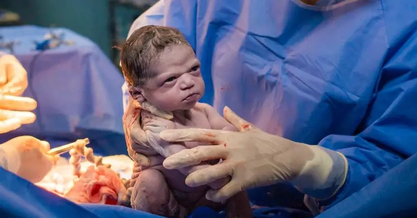 L’histoire derrière la photo du bébé énervé, devenu un mème dès sa naissance