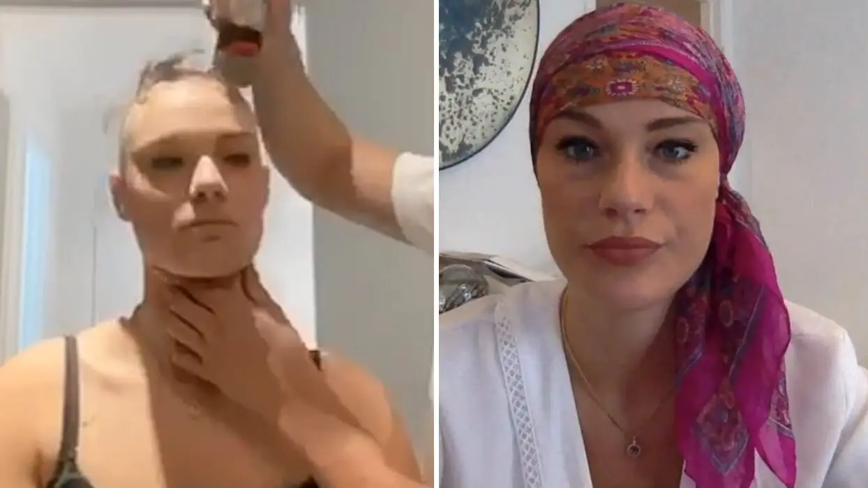 Vidéo : atteinte d’alopécie, Eva a décidé de se raser la tête