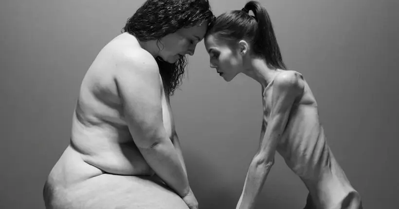 Le combat de deux femmes anorexique et obèse immortalisé par Joanna Watala