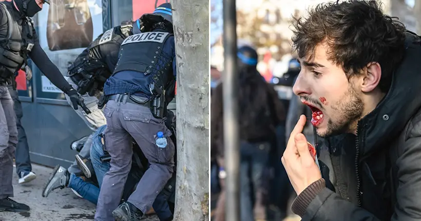 Violences policières à Lyon : neufs dents cassées et un procès reporté
