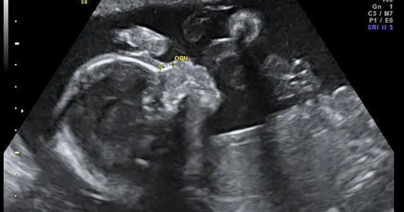 Un bébé a enregistré un album… dans le ventre de sa mère