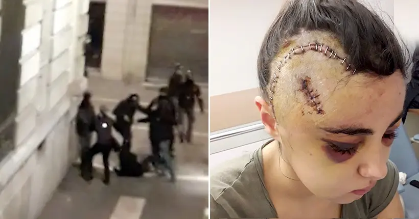 Vidéo : les policiers qui m’ont agressée sont introuvables
