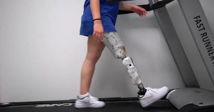 Vidéo : à 16 ans, Nélia raconte son quotidien avec une prothèse
