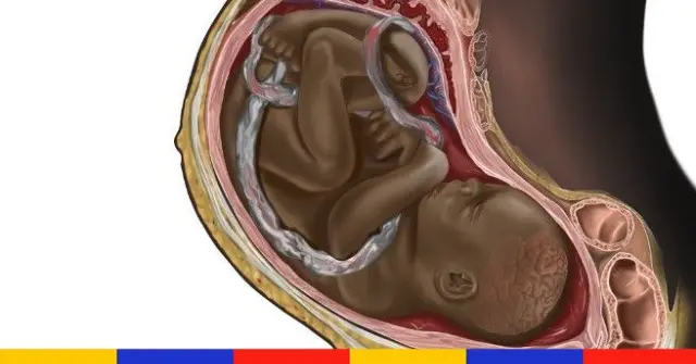 Pourquoi cette image d’un fœtus noir est devenue virale