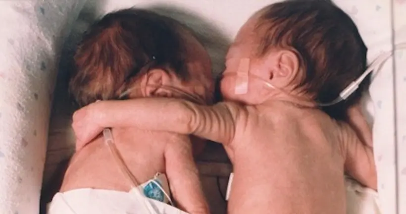 L’histoire touchante derrière cette photo de bébés jumelles en plein câlin (et comment il a changé leur vie)