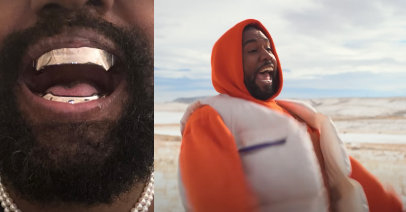 Kanye West s’est-il vraiment fait retirer les dents pour mettre un grillz en titane ?